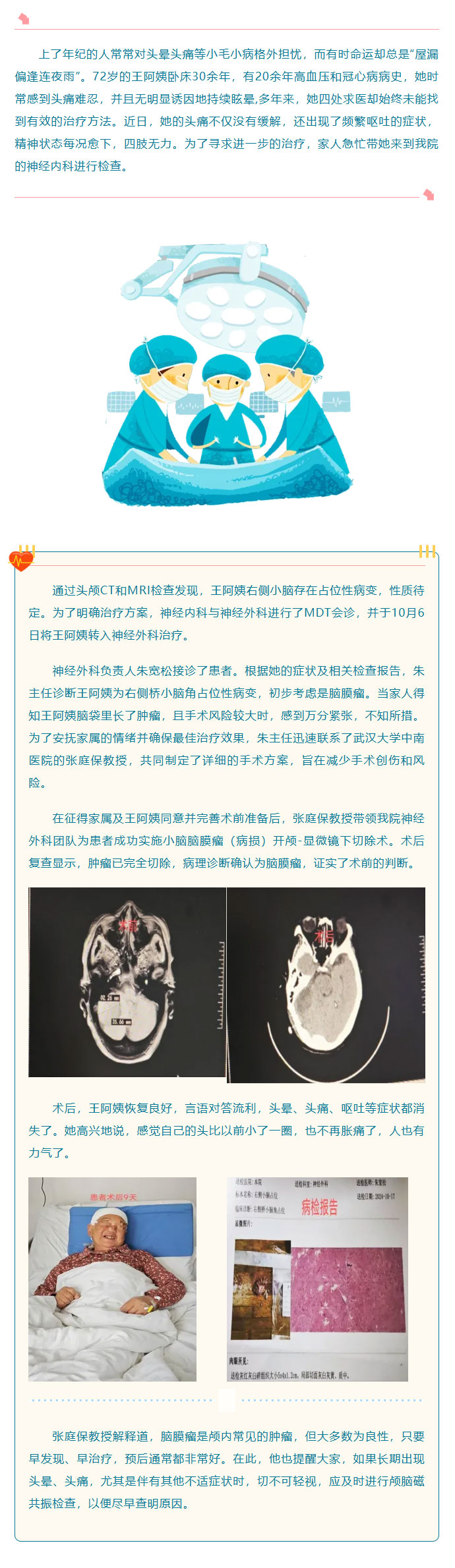 精准医疗：脑膜瘤切除术助力患者摆脱头晕头痛顽疾1.jpg
