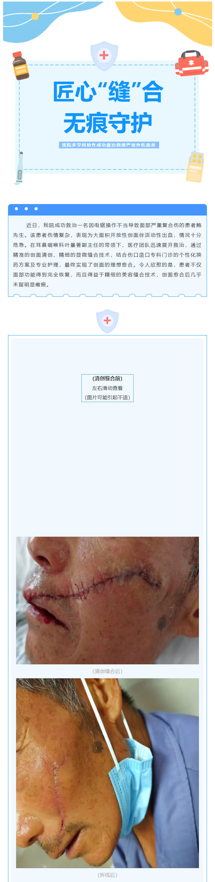 匠心“缝”合，无痕守护——我院多学科协作成功救治面部严重外伤患者01.jpg
